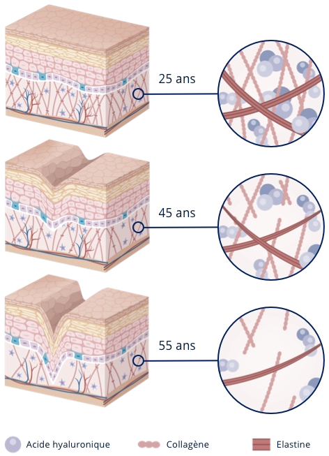 Grafik Faktoren der Hautalterung (fr)
