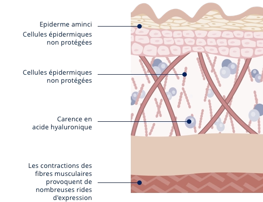 Grafik Haut vor einer Behandlung (fr)
